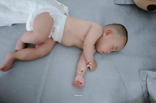 咸阳六个月宝宝眼睛散光